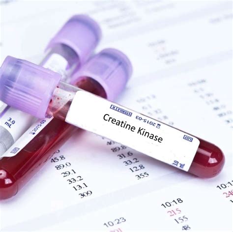 ck blood test bottle|creatine kinase ck testing.